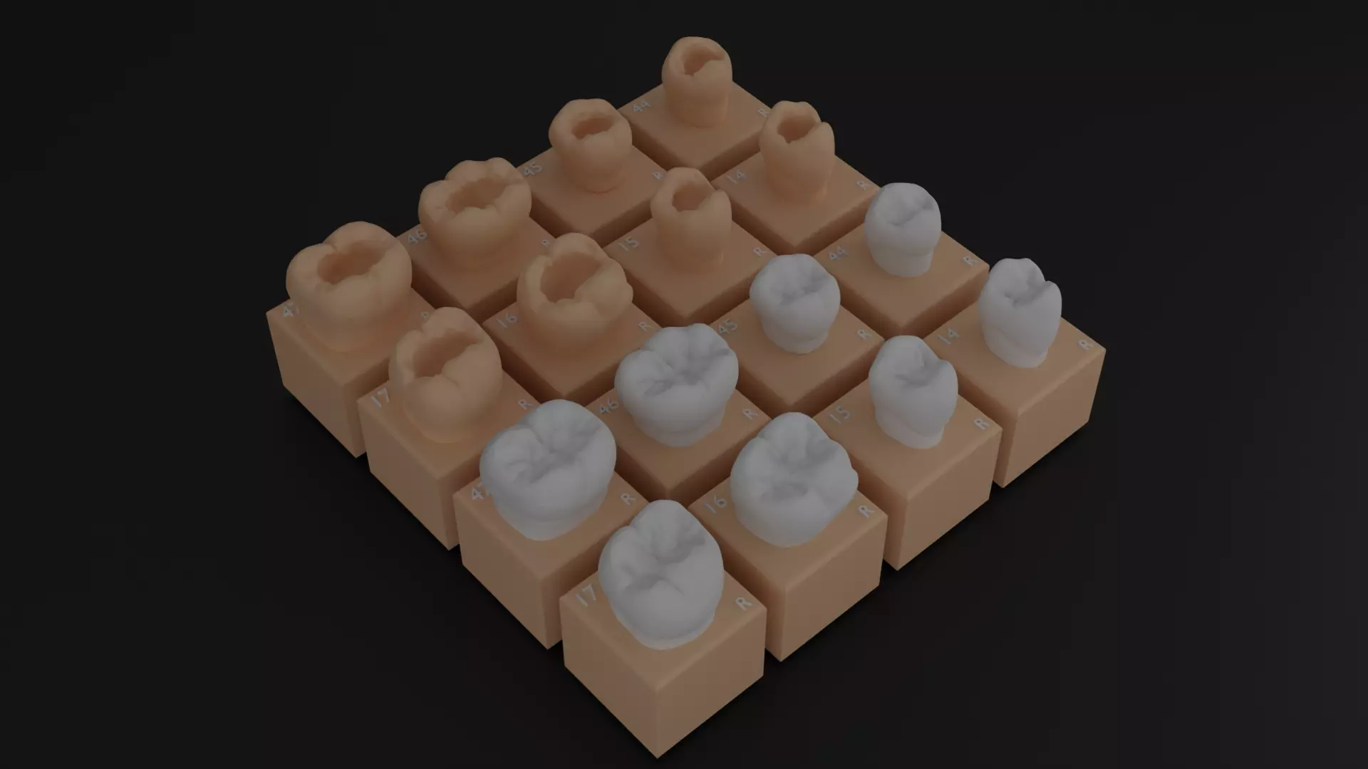 Platform teeth 3D print model_0