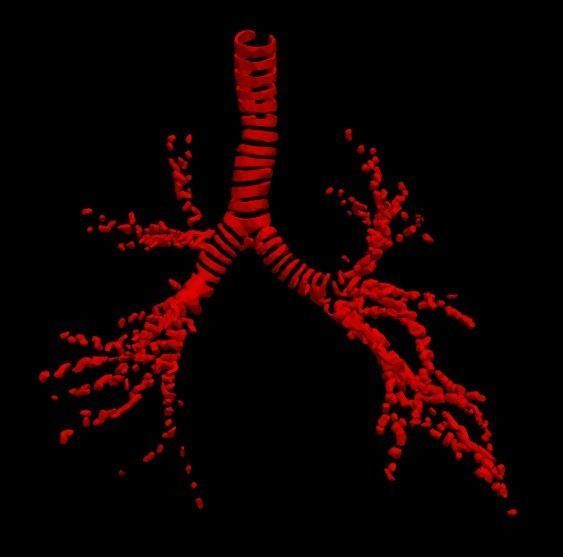 3d model of cardiovascular system thorax and abdomen 3D print model_15