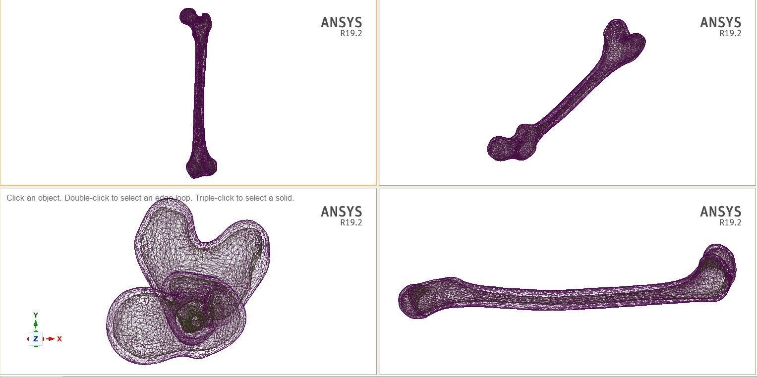 FEMUR 3D MODEL WITH CORTICAL AND CANCELLOUS BONE 3D print model_12