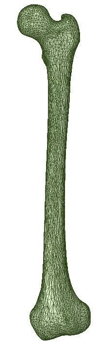 FEMUR 3D MODEL WITH CORTICAL AND CANCELLOUS BONE 3D print model_6
