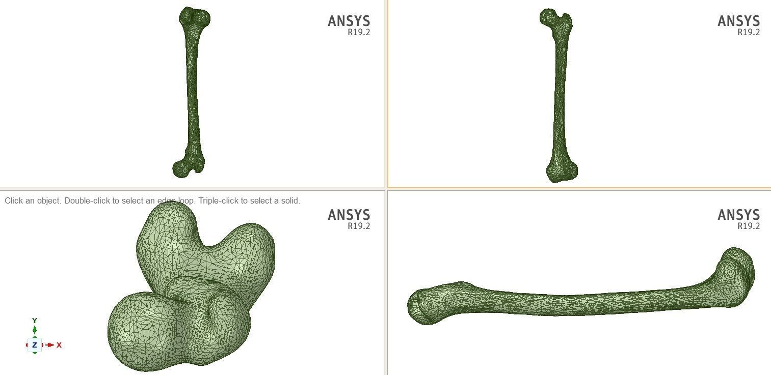 FEMUR 3D MODEL WITH CORTICAL AND CANCELLOUS BONE 3D print model_3