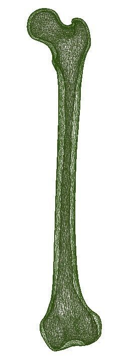 FEMUR 3D MODEL WITH CORTICAL AND CANCELLOUS BONE 3D print model_5
