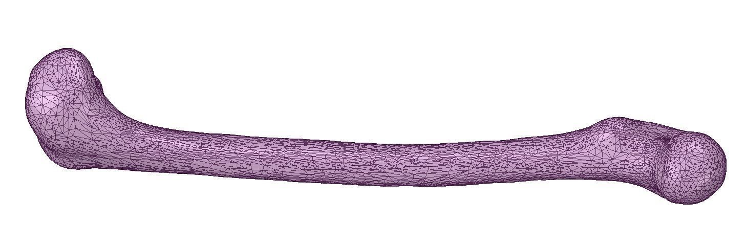 FEMUR 3D MODEL WITH CORTICAL AND CANCELLOUS BONE 3D print model_9