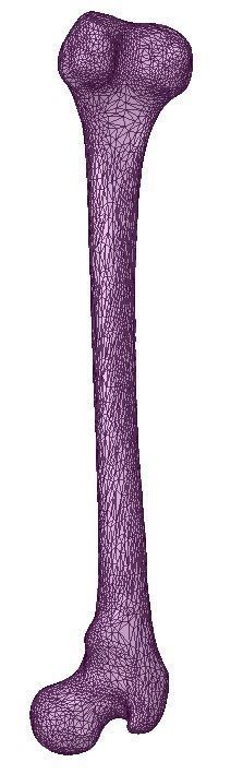 FEMUR 3D MODEL WITH CORTICAL AND CANCELLOUS BONE 3D print model_7