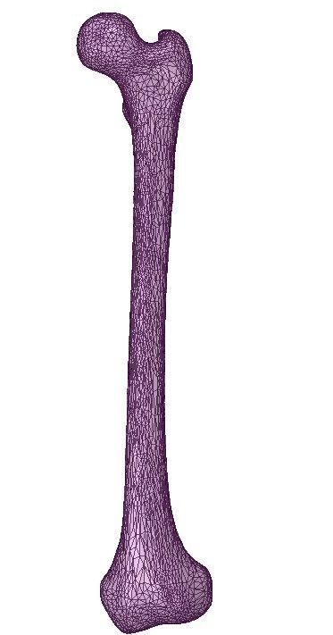 FEMUR 3D MODEL WITH CORTICAL AND CANCELLOUS BONE 3D print model_11