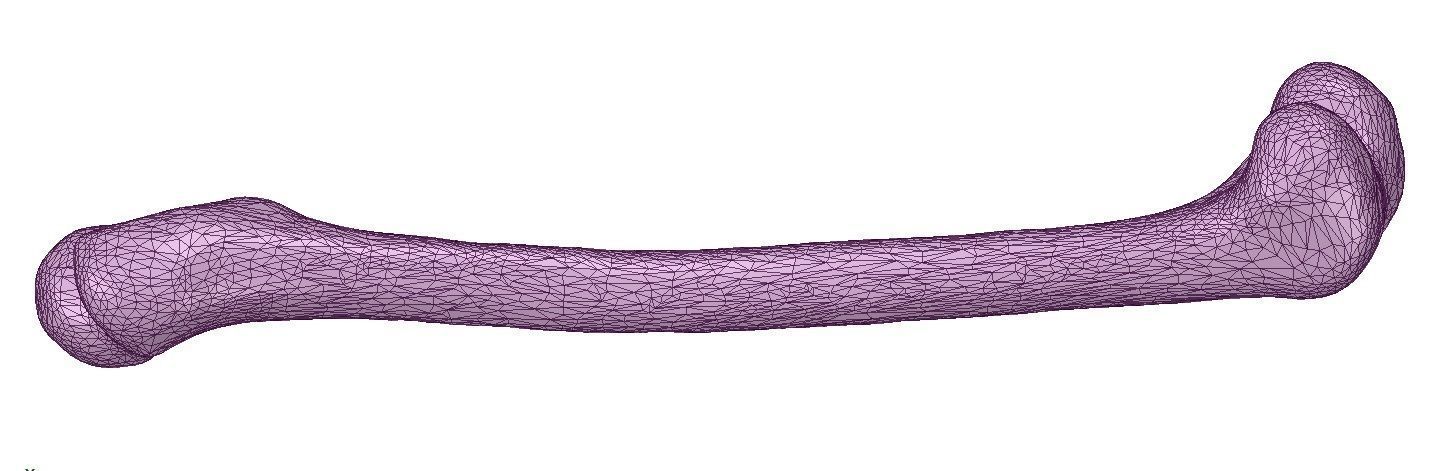 FEMUR 3D MODEL WITH CORTICAL AND CANCELLOUS BONE 3D print model_10