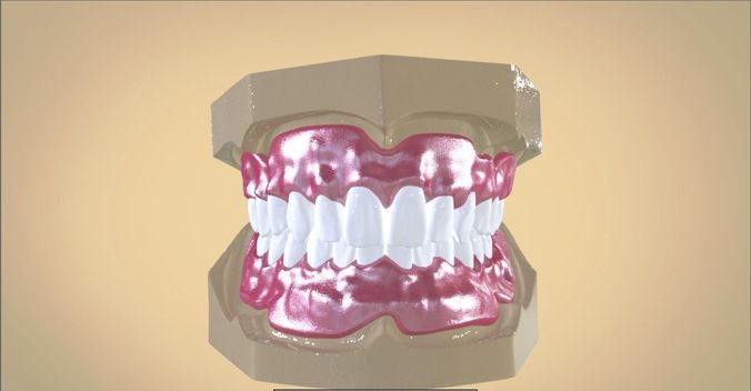 Digital Full Dentures 3D print model