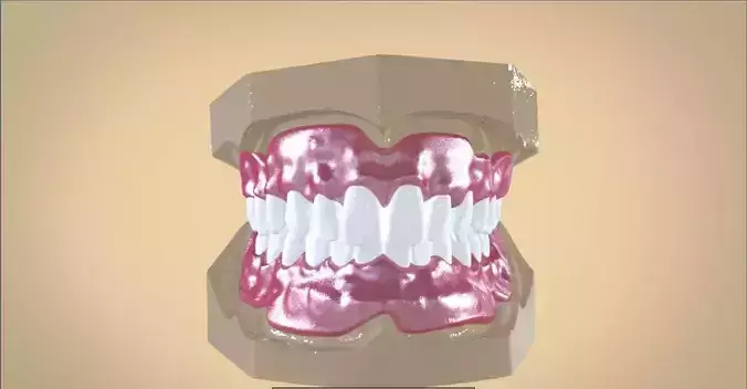 Digital Full Dentures 3D print model