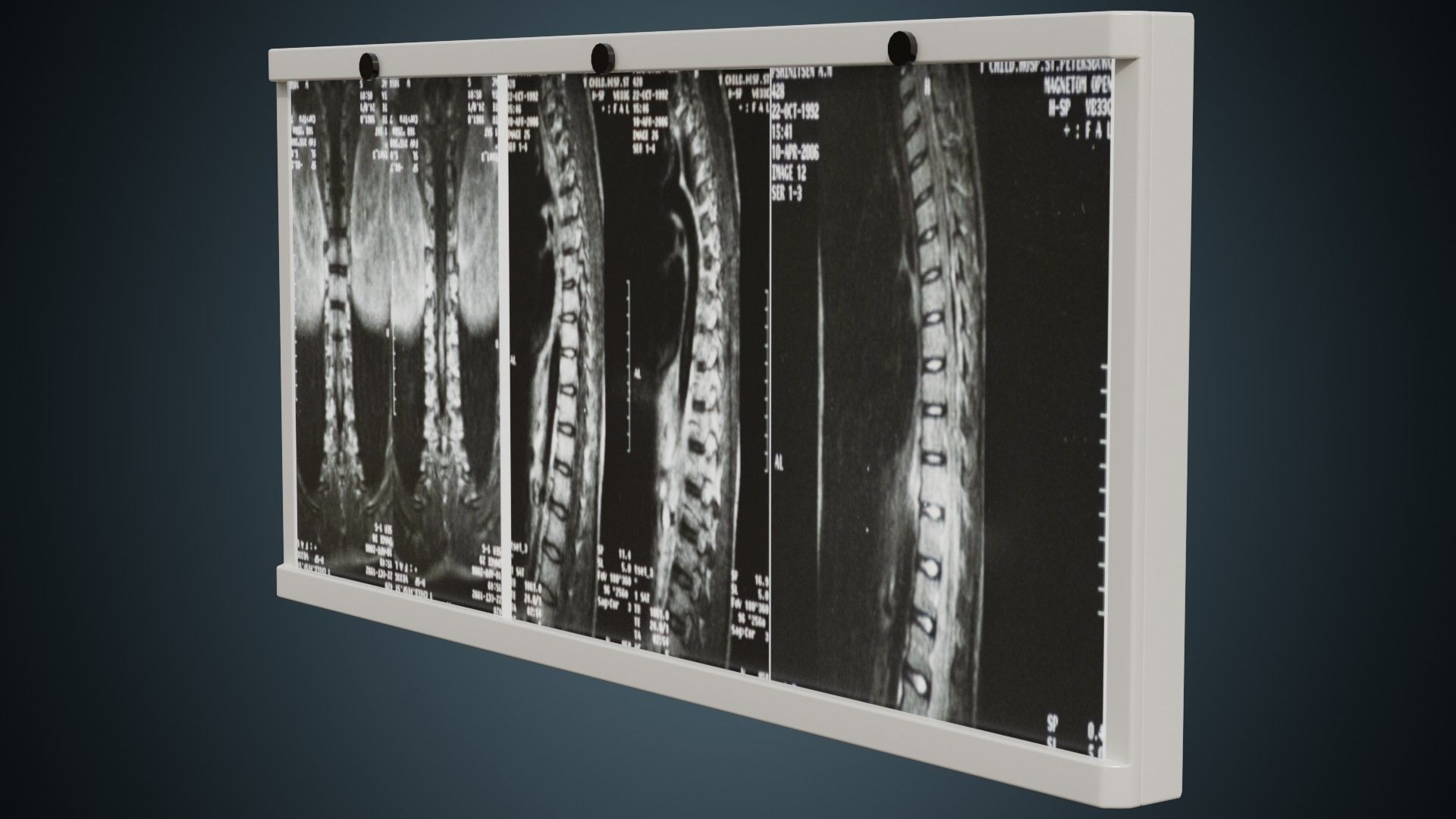 Hospital Props Collection 1A _35