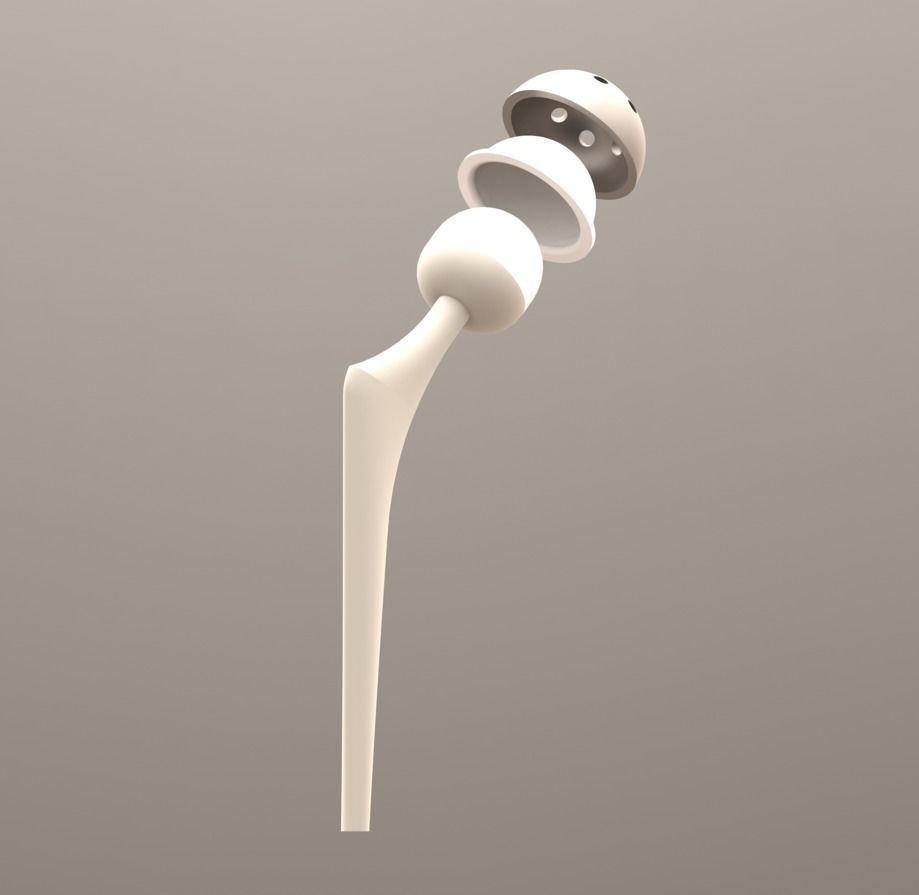 hip prosthesis 3D print model_1