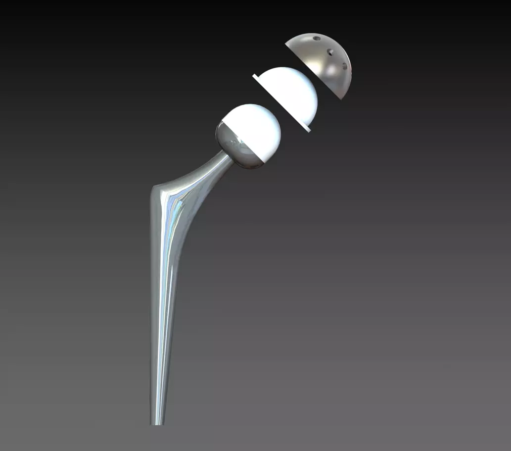 hip prosthesis 3D print model_0