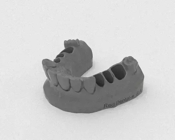 Dental Model wax-up