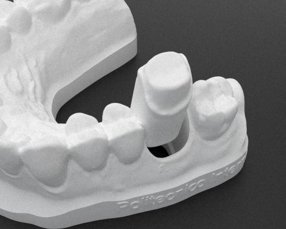 Model practices veneers 3D print model_2