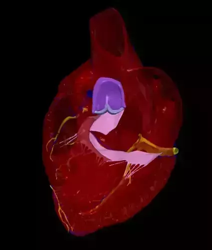 3d model of heart with atrioventricular septal defect 4 chamber 3D print model