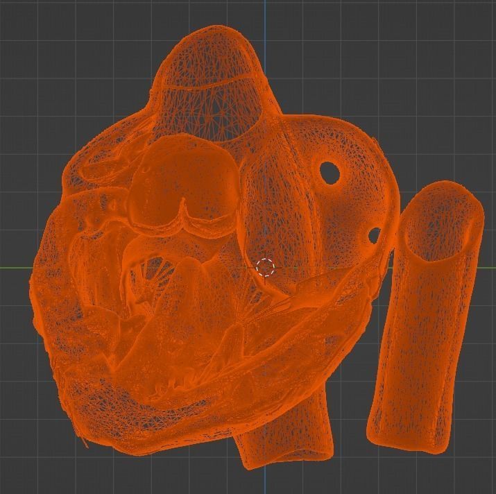 3d model of the heart with tetralogy of Fallot long axis 3D print model_11