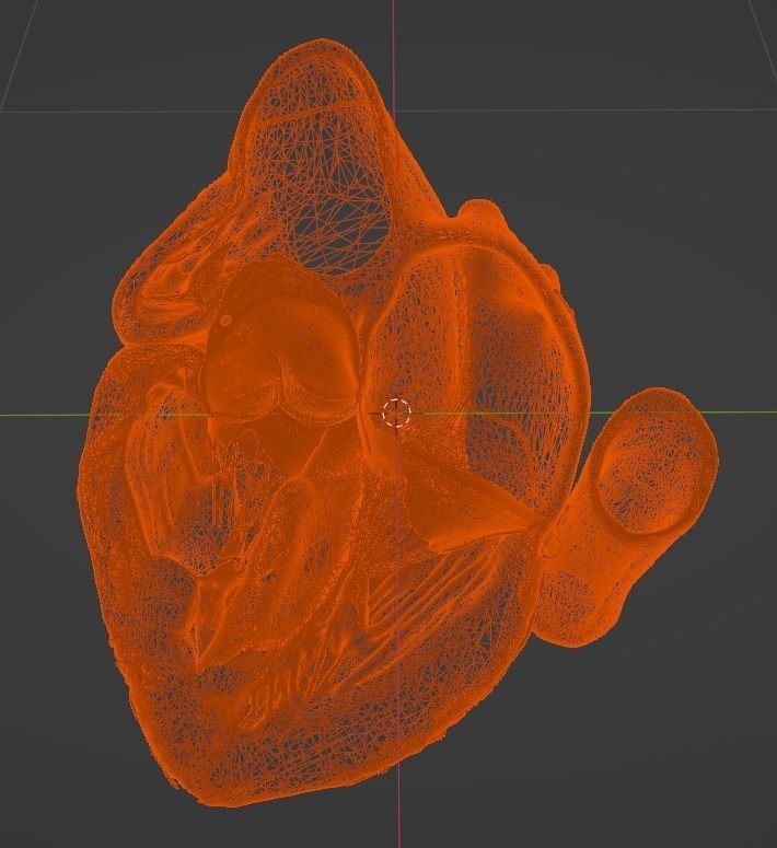3d model of the heart with tetralogy of Fallot long axis 3D print model_8
