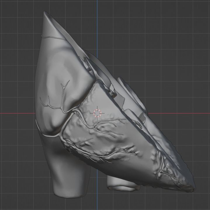 3d model of the heart with tetralogy of Fallot long axis 3D print model_7