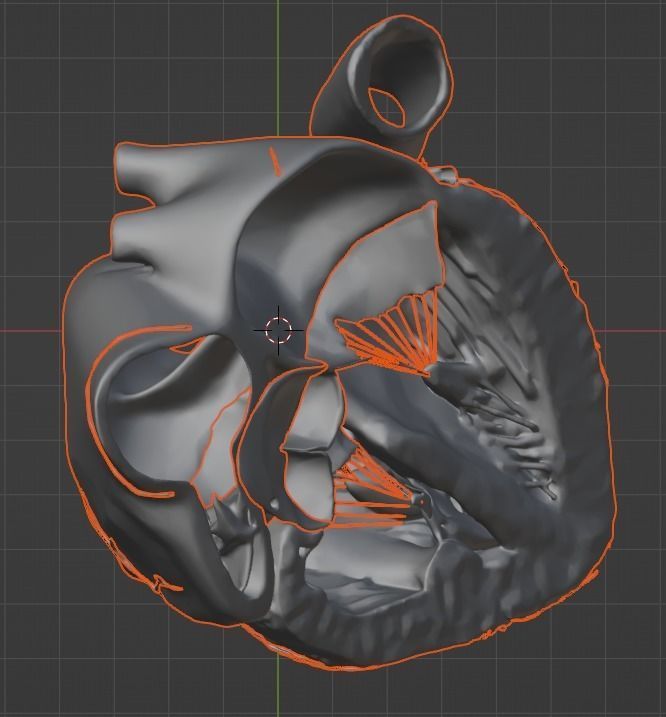 3d model of the heart with tetralogy of Fallot long axis 3D print model_12