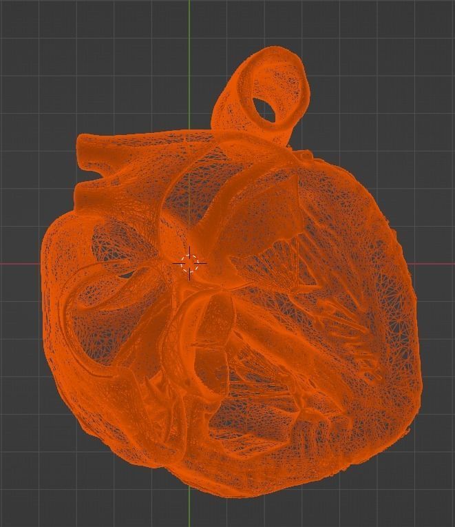 3d model of the heart with tetralogy of Fallot long axis 3D print model_13