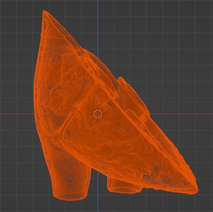 3d model of the heart with tetralogy of Fallot long axis 3D print model_9