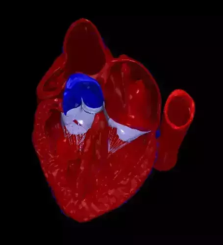 3d model of the heart with tetralogy of Fallot long axis 3D print model