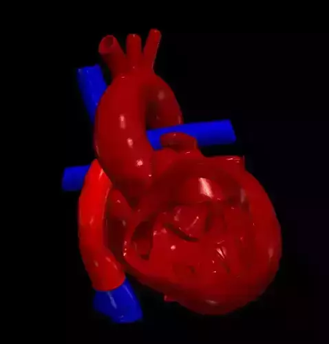 3d model of heart after fontan procedure