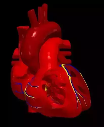 3d model of heart with atrial septal defect 3D print model
