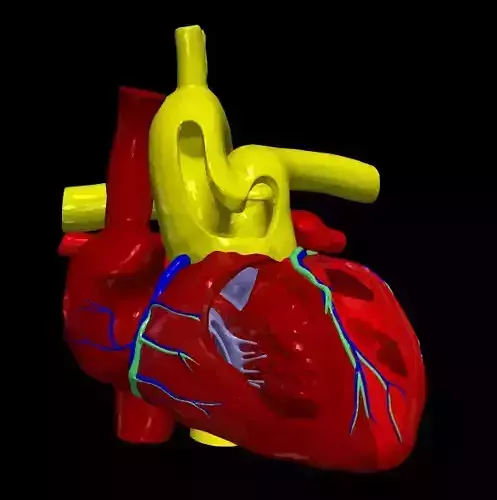 3d model of heart with common arterial trunk