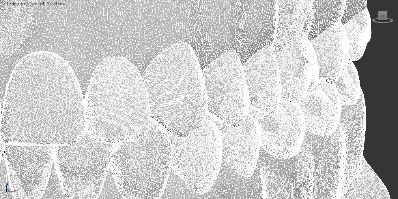 Dental Model 3D model_21