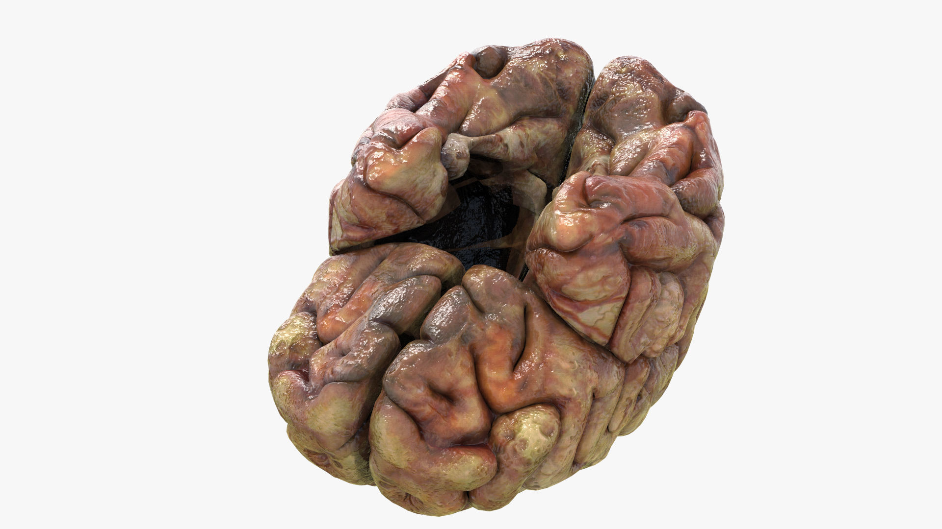 Gory Human Brain Damaged Low-poly 3D model_4