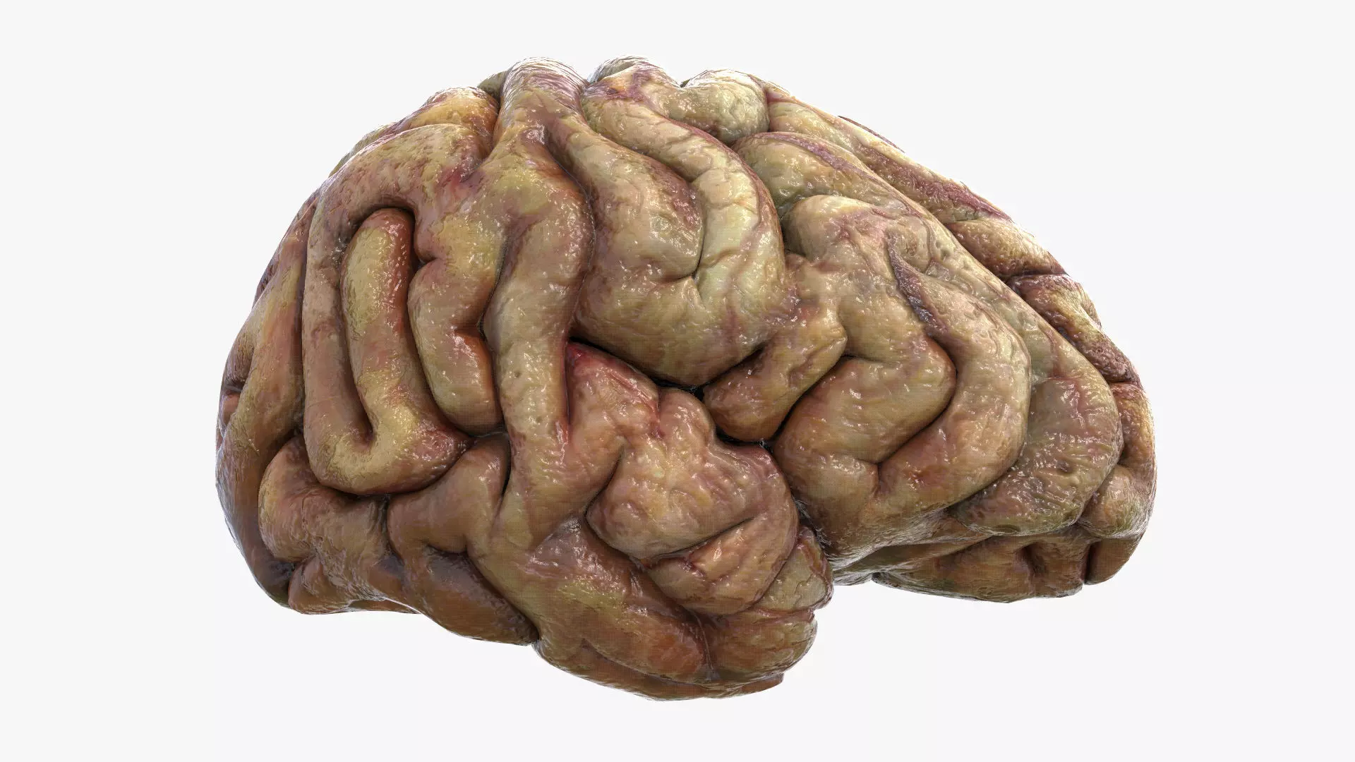 Gory Human Brain Damaged Low-poly 3D model_0