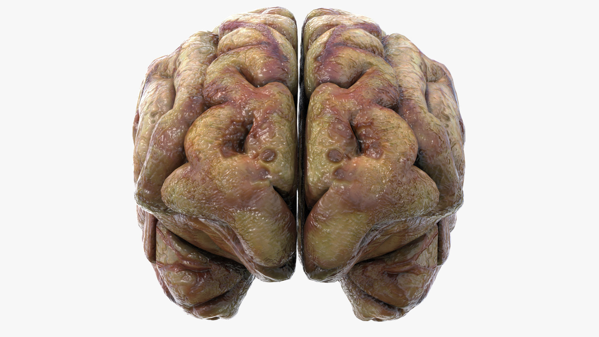 Gory Human Brain Damaged Low-poly 3D model_5