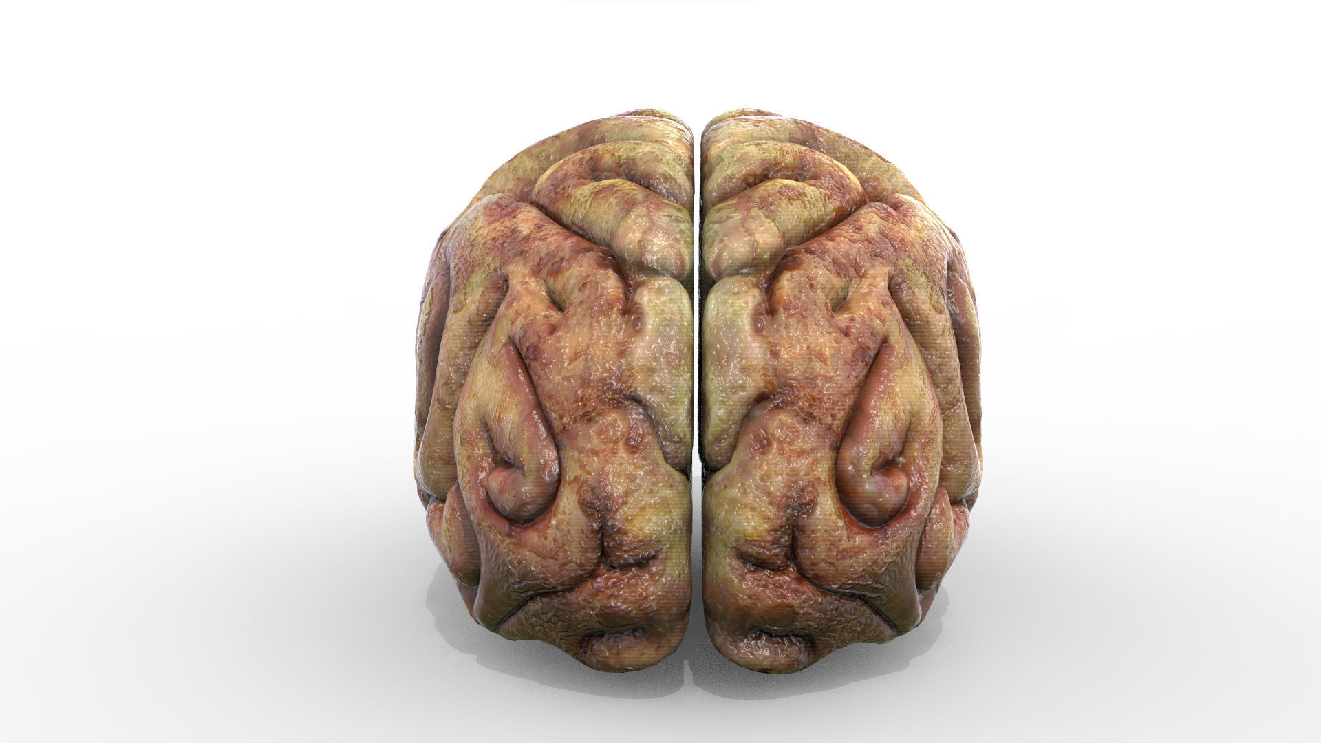 Gory Human Brain Damaged Low-poly 3D model_2