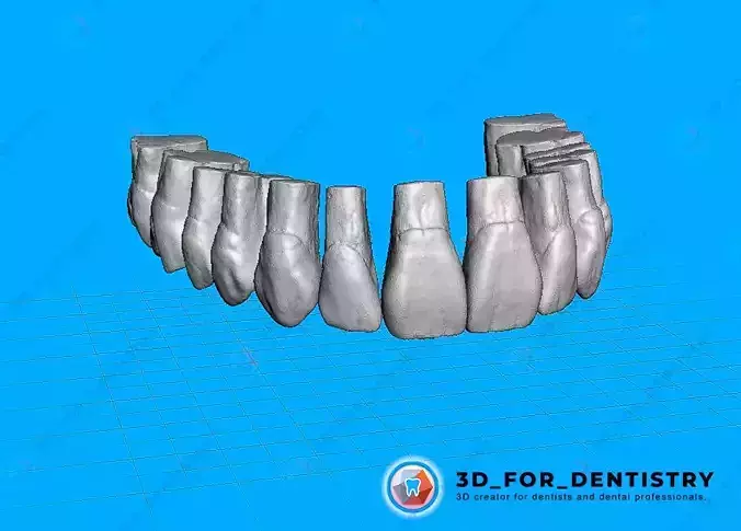Dentes Maxila e Mandibula - Robtoly-Unique - Exocad