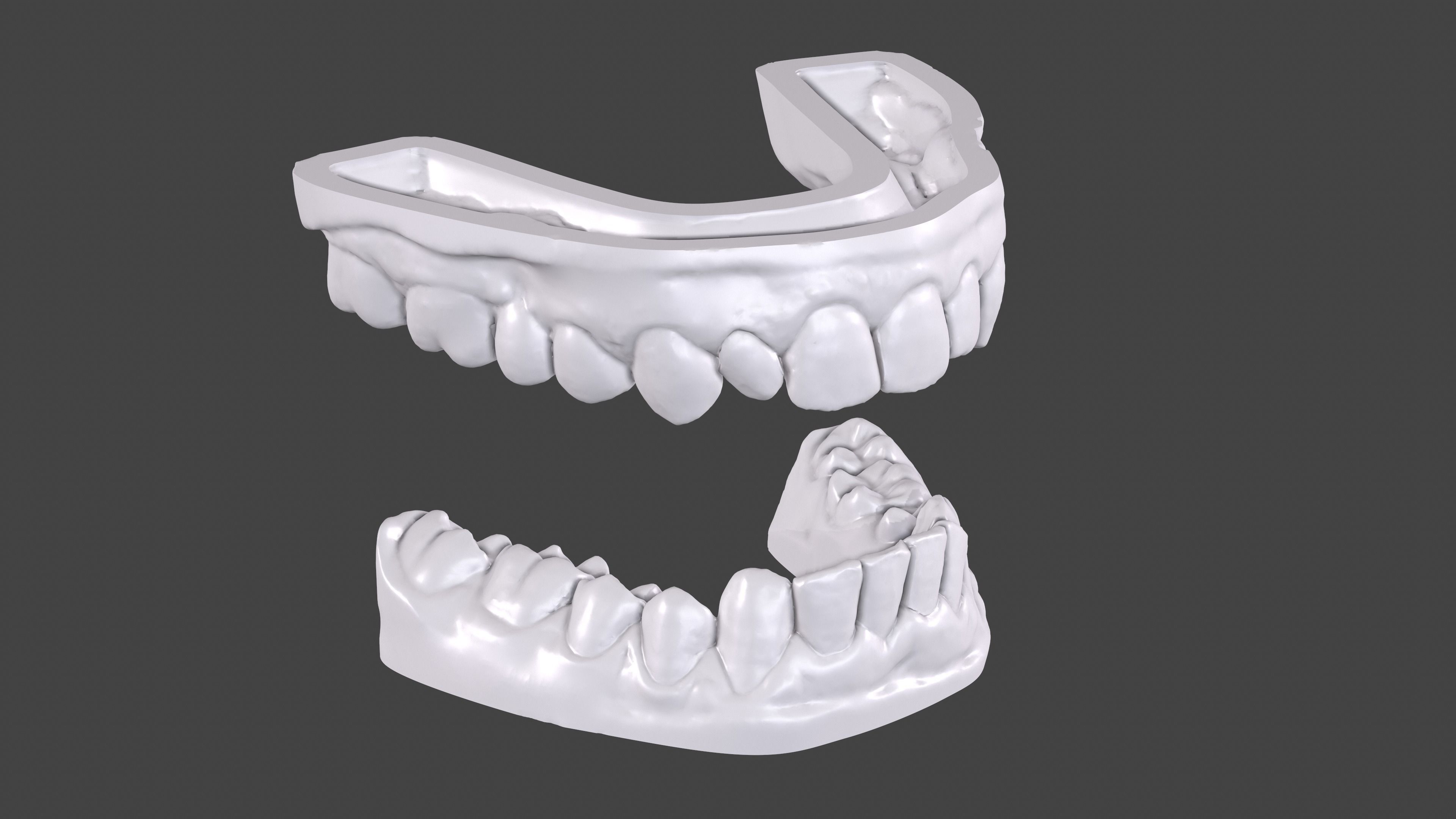 Dental Anatomy 11 Models Real Scanned Medical Case mouthes  3D print model_2