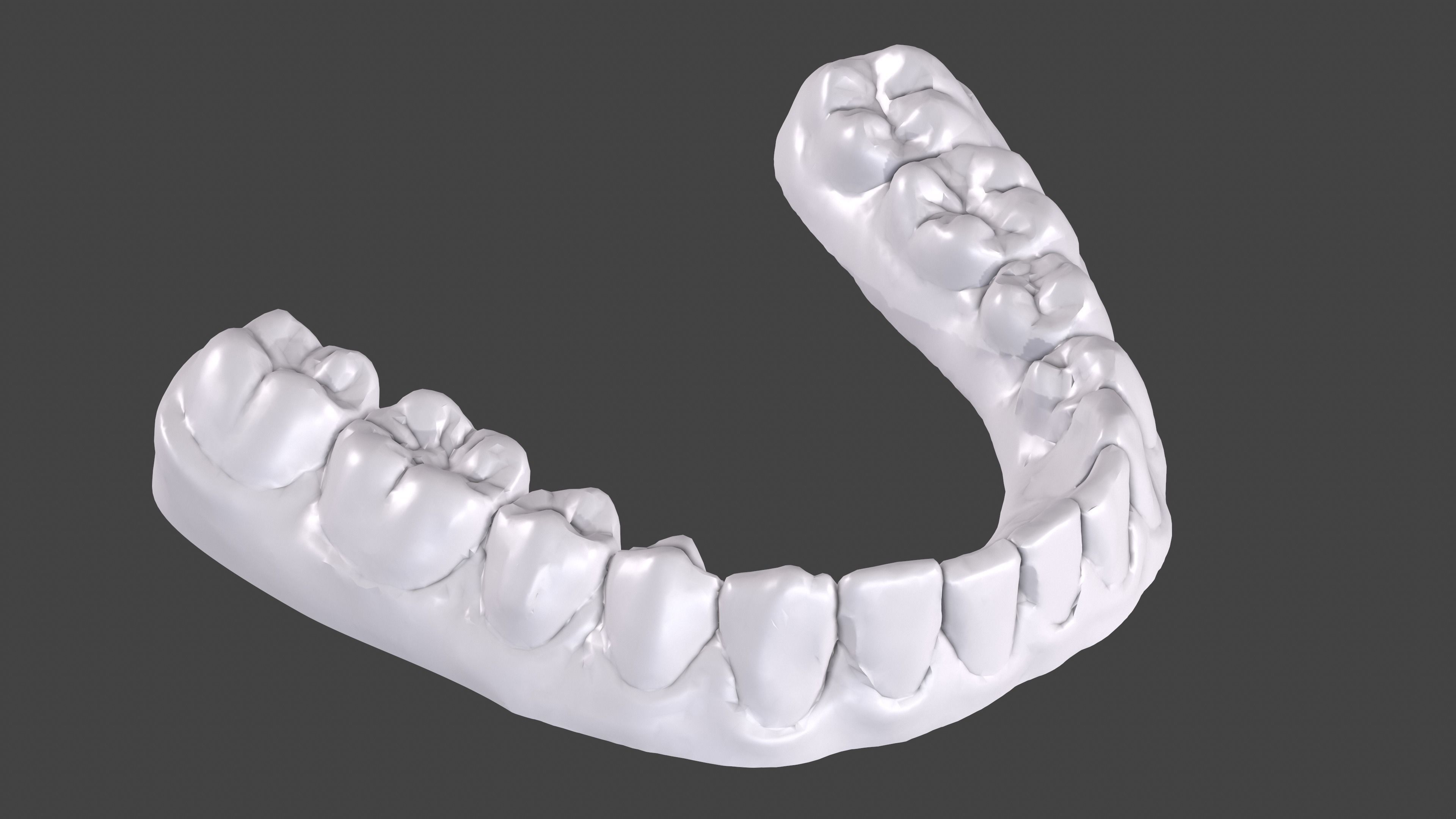 Dental Anatomy 11 Models Real Scanned Medical Case mouthes  3D print model_4
