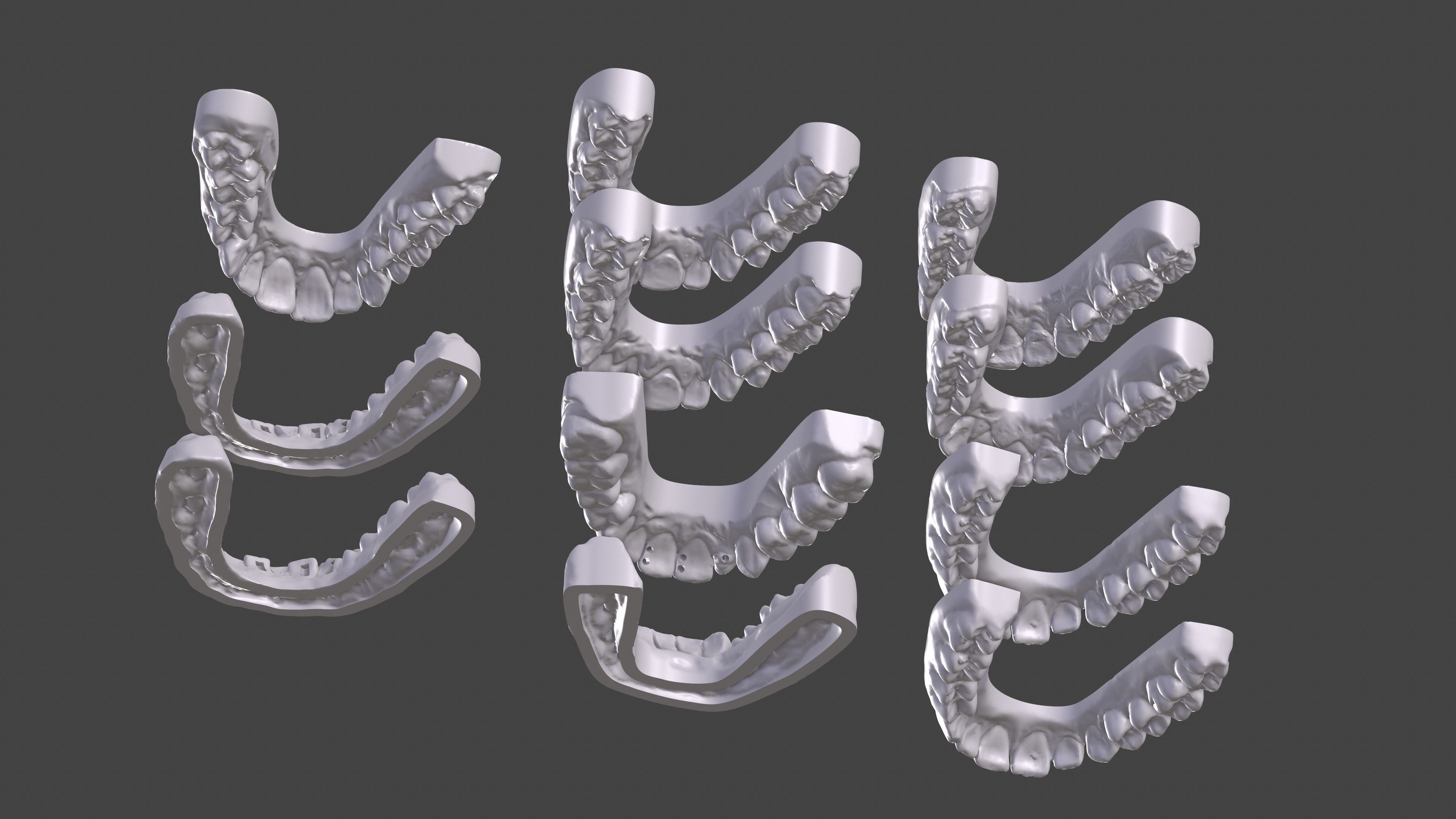 Dental Anatomy 11 Models Real Scanned Medical Case mouthes  3D print model_6
