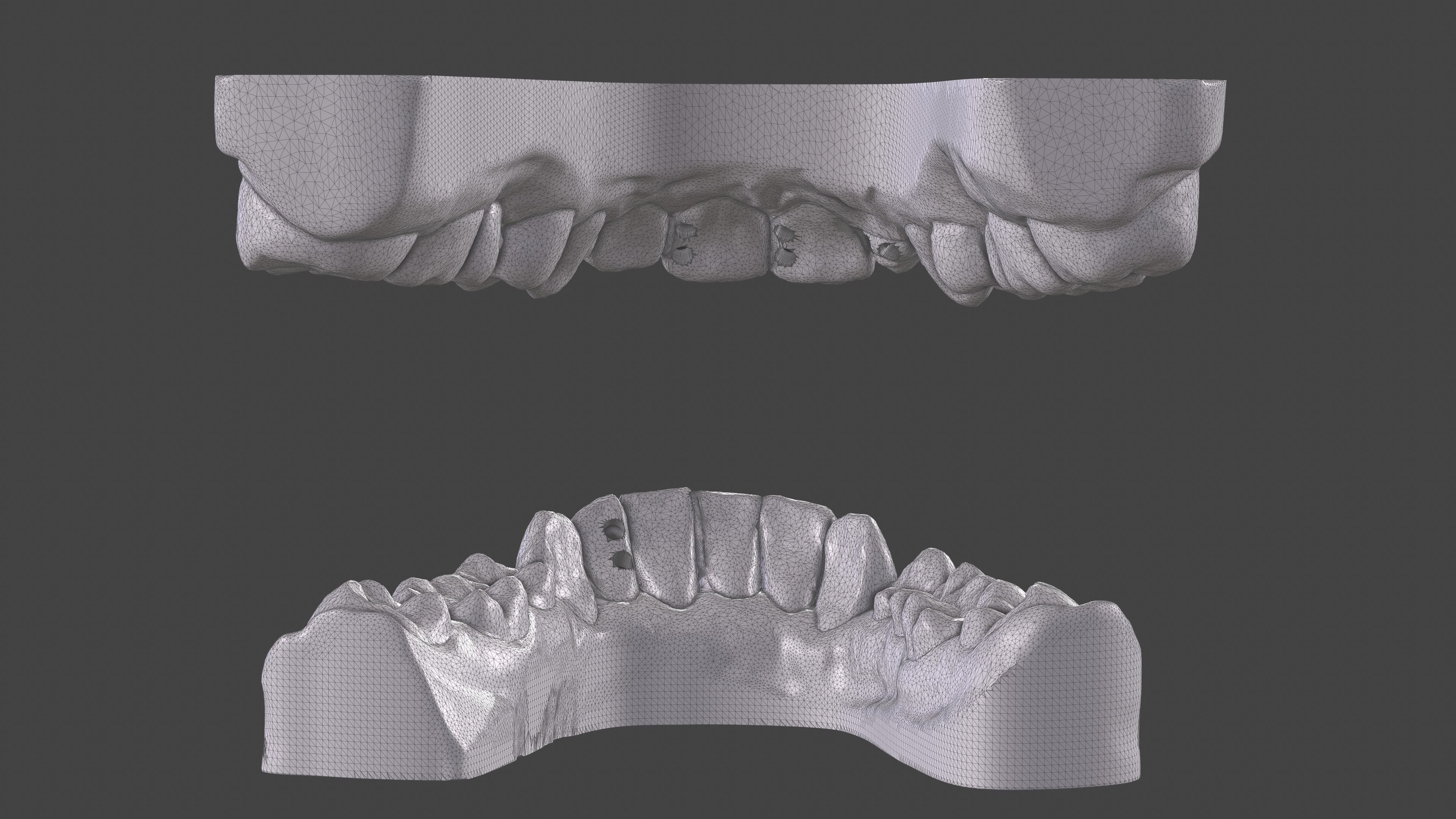 Dental Anatomy 11 Models Real Scanned Medical Case mouthes  3D print model_8