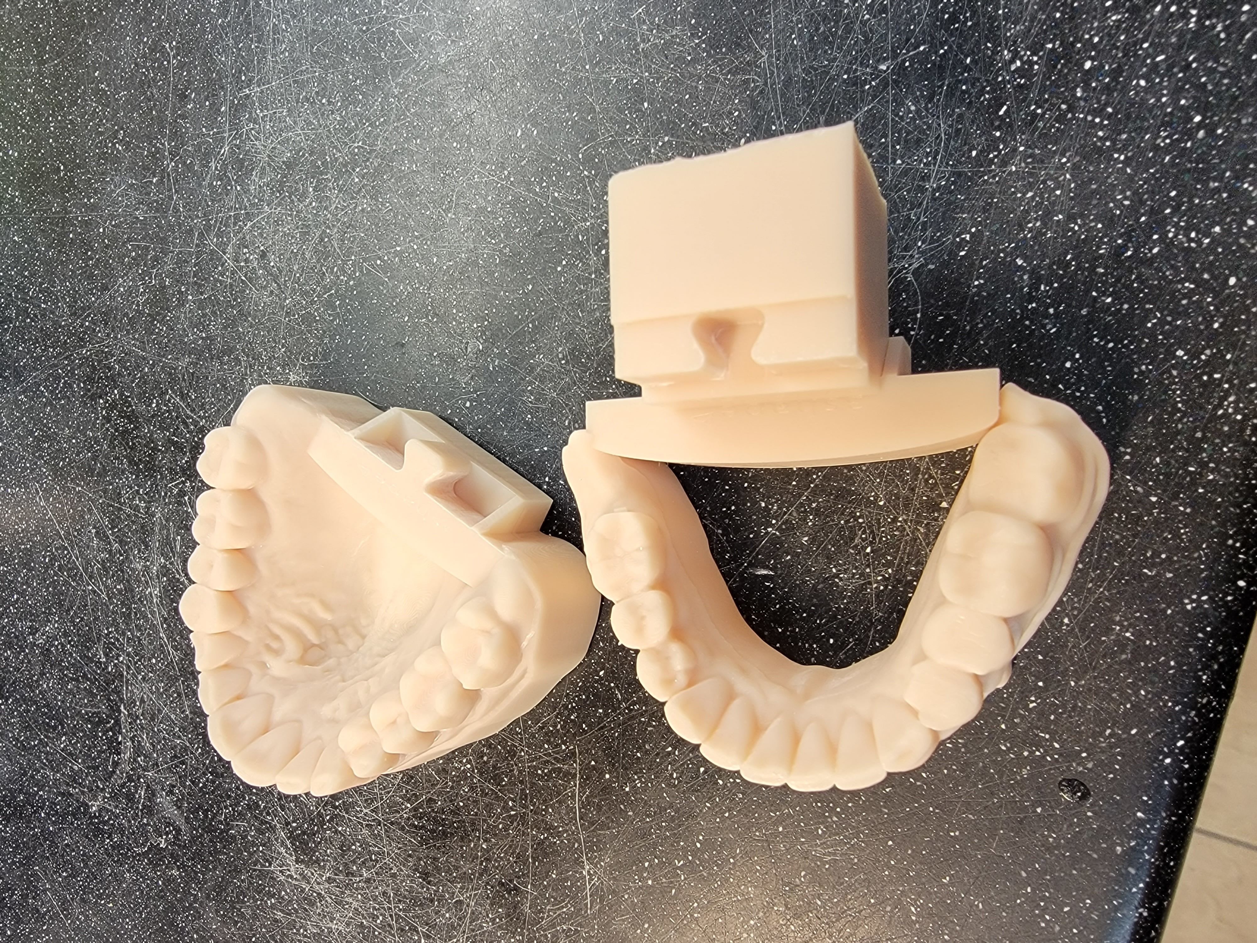 3shape opening articulator for dental models 3D print model_3