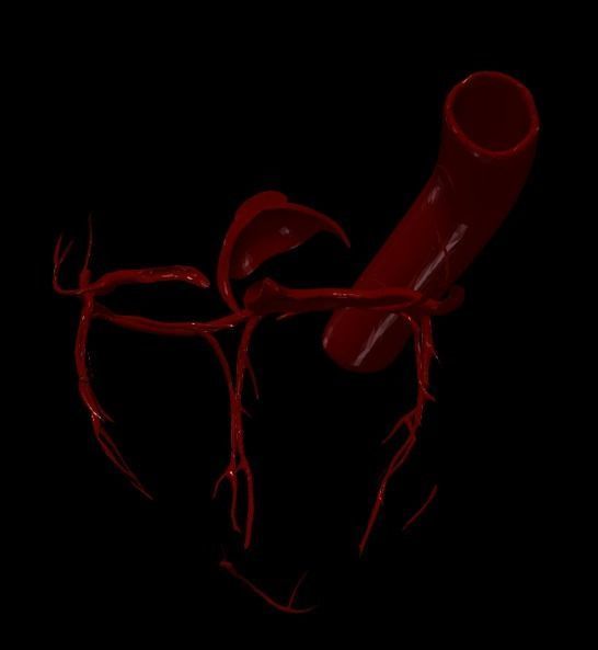 3D Model of Heart Chambers 2 pack 3D model_6