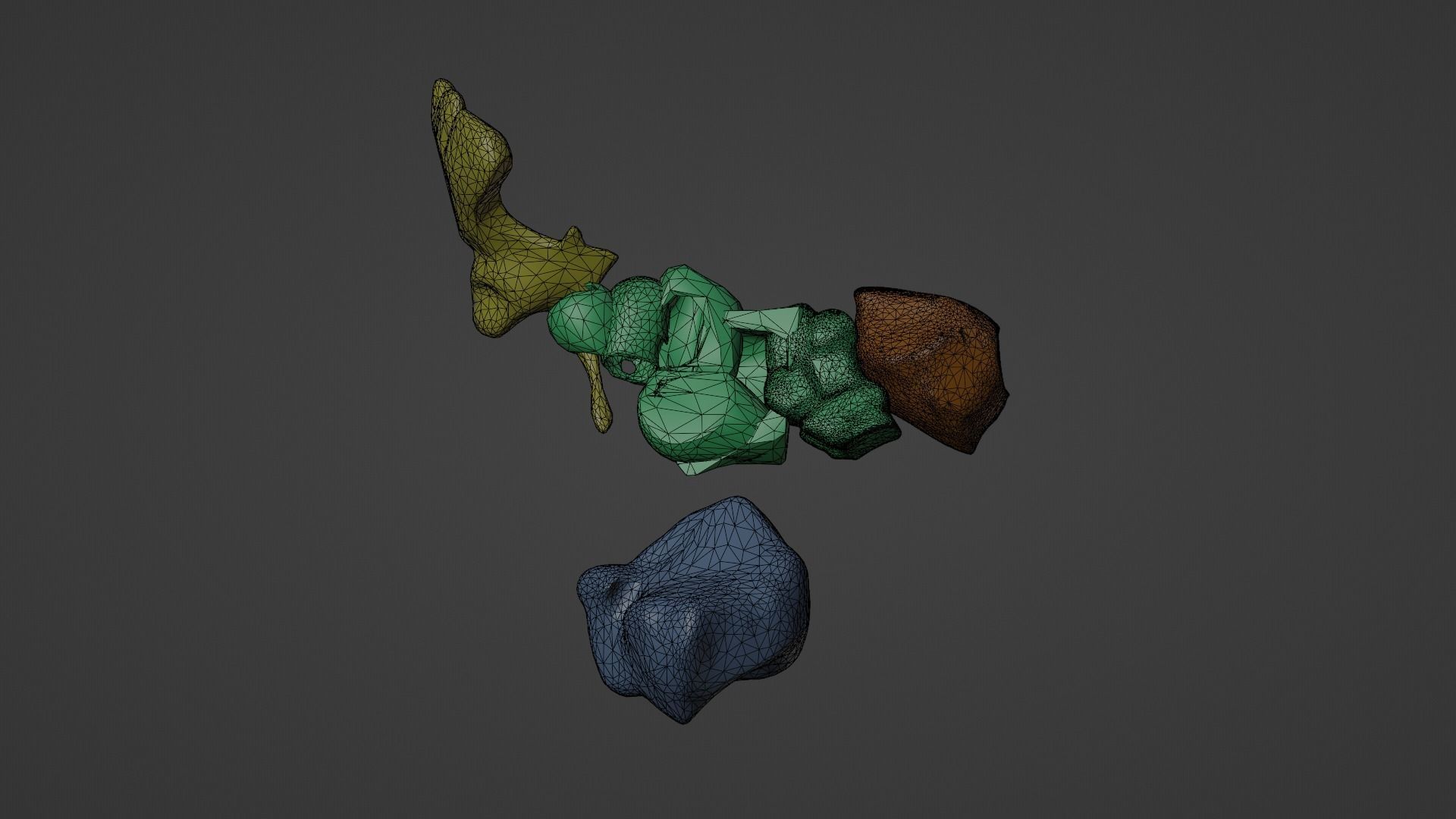 3D Model of Paranasal Sinuses 3D model_2