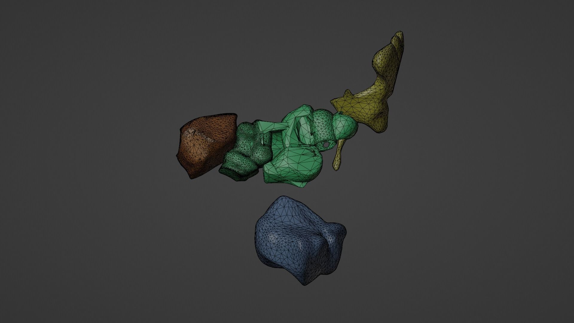 3D Model of Paranasal Sinuses 3D model_7