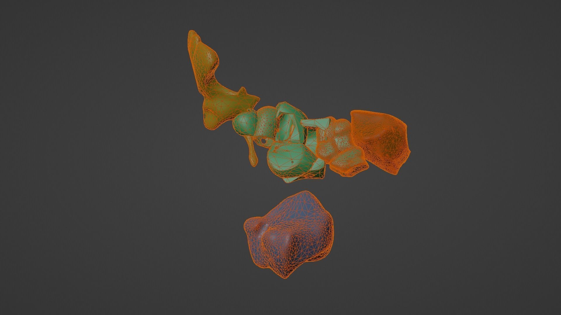 3D Model of Paranasal Sinuses 3D model_17