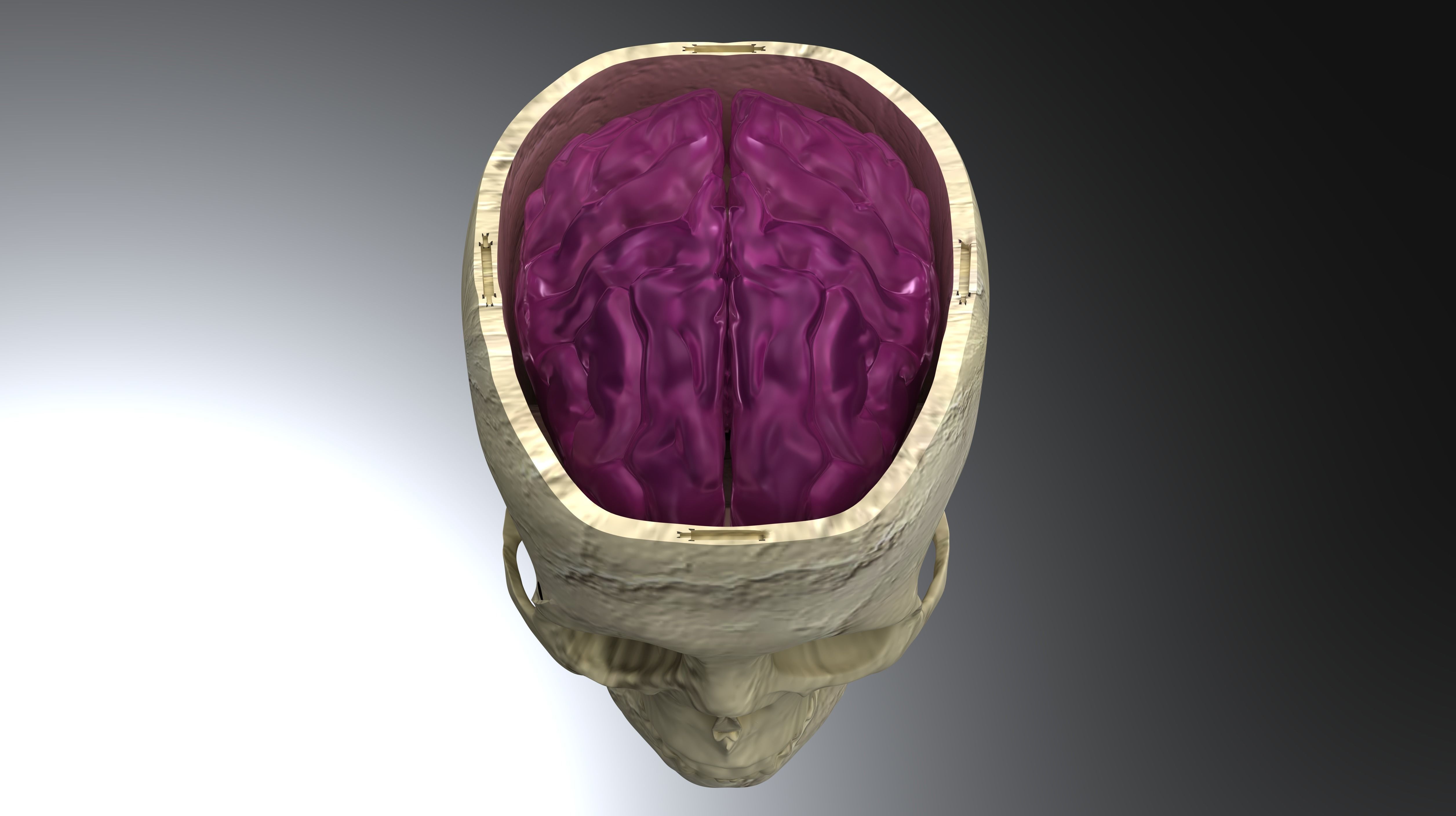 Insertable Human Skull and Brain 3D print model_3