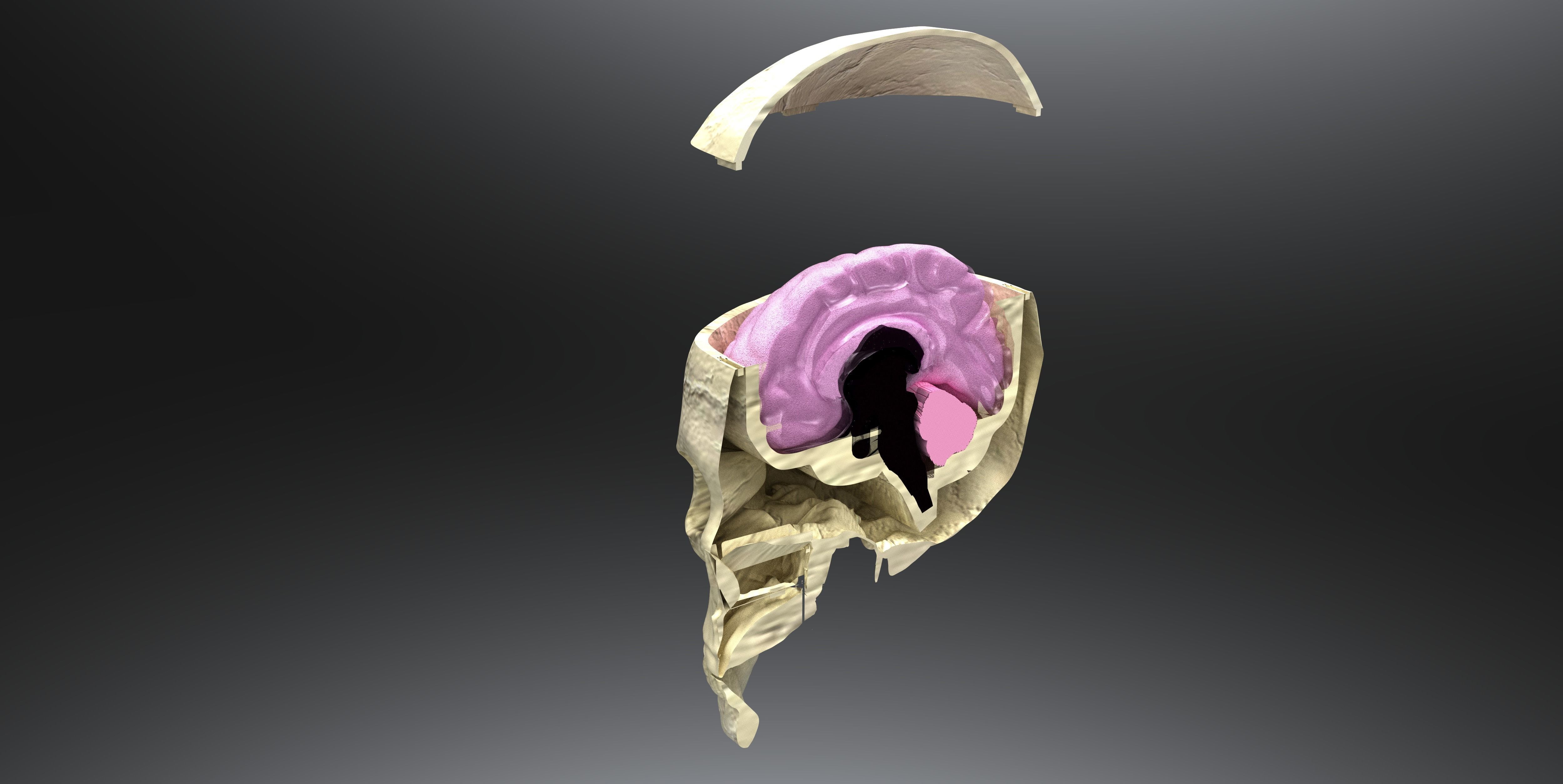 Insertable Human Skull and Brain 3D print model_8