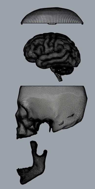 Insertable Human Skull and Brain 3D print model_13