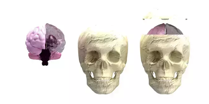 Insertable Human Skull and Brain 3D print model