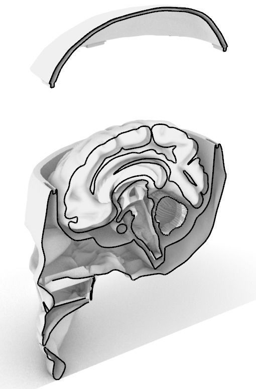 Insertable Human Skull and Brain 3D print model_16