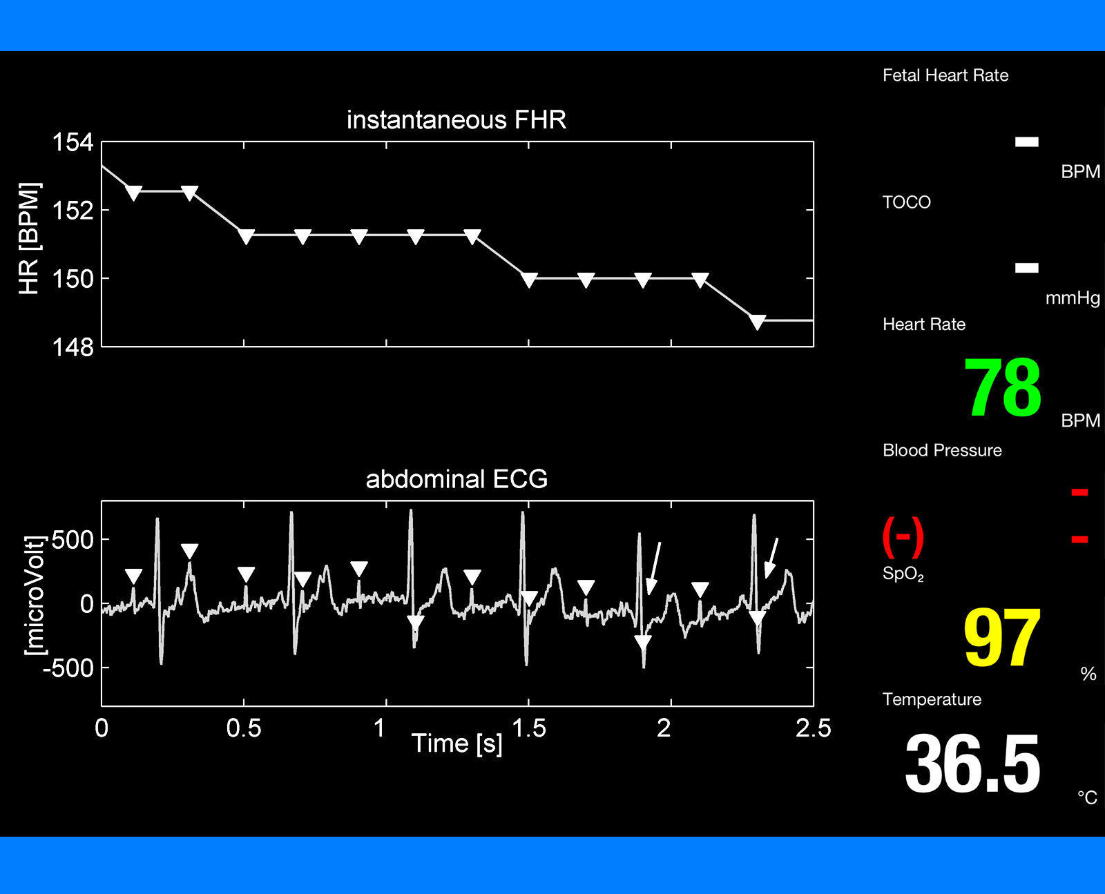 Fetal Monitor 3D model_19
