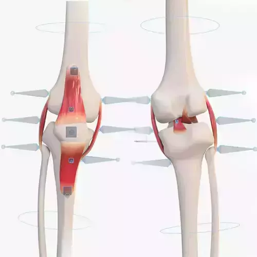 Knee anatomy template Low-poly 3D model